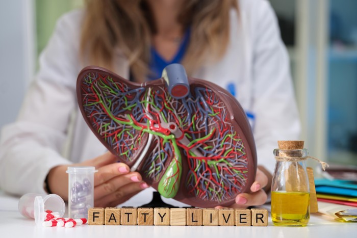 Fatty Liver